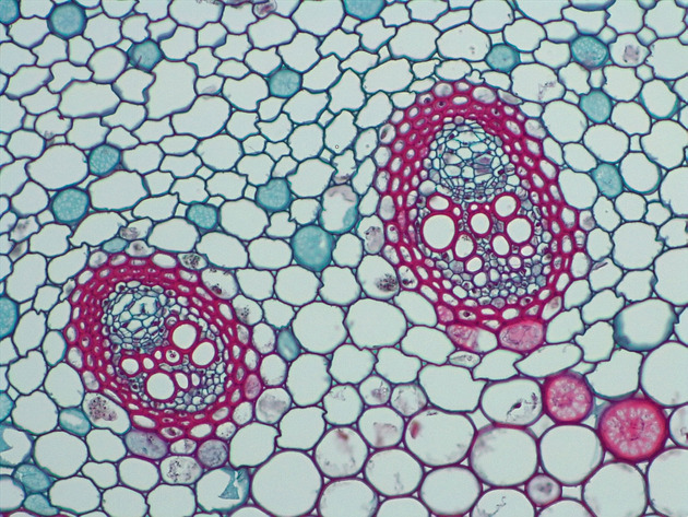 Plant Vascular Tissue Slides - Plant Vascular Tissue 02 200X